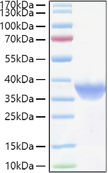 Recombinant Human FR-alpha/FOLR1 Protein was determined by SDS-PAGE under reducing conditions with Coomassie Blue.