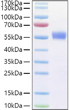 Recombinant Human B29/CD79B Protein was determined by SDS-PAGE under reducing conditions with Coomassie Blue.