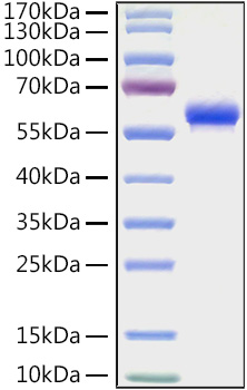Recombinant Human Fc gamma RIIA/FCGR2A/CD32a (H167R) Protein was determined by SDS-PAGE under reducing conditions with Coomassie Blue.
