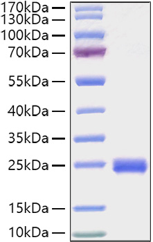 Recombinant Mouse IL-2 Protein was determined by SDS-PAGE under reducing conditions with Coomassie Blue.