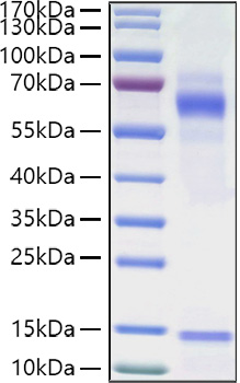 Recombinant Human Vitronectin/V75/VTN Protein was determined by SDS-PAGE under reducing conditions with Coomassie Blue.