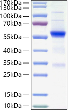 Recombinant Human TET2 Protein was determined by SDS-PAGE under reducing conditions with Coomassie Blue.