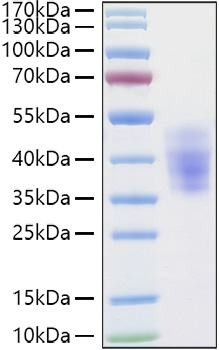 Recombinant Human NKAT-2/KIR2DL3/CD158b2 Protein was determined by SDS-PAGE under reducing conditions with Coomassie Blue.