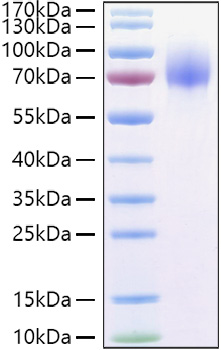 Recombinant Human Osteoactivin/GPNMB Protein was determined by SDS-PAGE under reducing conditions with Coomassie Blue.