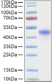 Recombinant Human VSIG4 Protein was determined by SDS-PAGE under reducing conditions with Coomassie Blue.