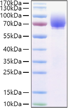 Recombinant Human Microtubule-associated protein tau/MAPT Protein was determined by SDS-PAGE under reducing conditions with Coomassie Blue.