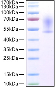 Recombinant Mouse CX3CL1/Fractalkine Protein was determined by SDS-PAGE under reducing conditions with Coomassie Blue.