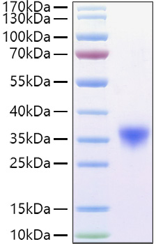 Recombinant Mouse Fc-gamma RIV/FCGR3A/CD16a Protein was determined by SDS-PAGE under reducing conditions with Coomassie Blue.