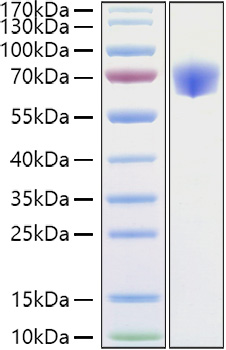 Recombinant Mouse TNFRSF1B/TNF-R2/CD120b Protein was determined by SDS-PAGE under reducing conditions with Coomassie Blue.