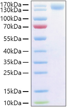 Recombinant Human P-Selectin/SELP/CD62P Protein was determined by SDS-PAGE under reducing conditions with Coomassie Blue.