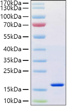 Recombinant Human REG-4 Protein was determined by SDS-PAGE under reducing conditions with Coomassie Blue.