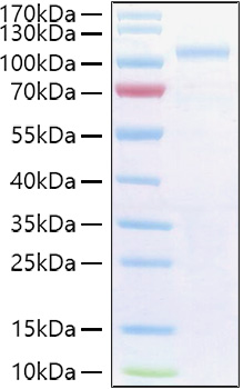 Recombinant Human Semaphorin-3G/SEMA3G Protein was determined by SDS-PAGE under reducing conditions with Coomassie Blue.