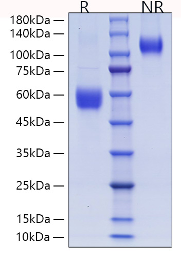 Recombinant Human ICOS/CD278 Protein was determined by SDS-PAGE under reducing (R) and non-reducing (NR) conditions.