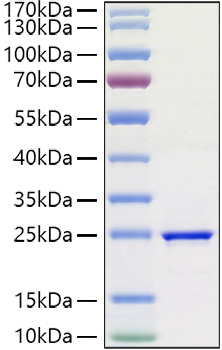 Recombinant Human FGF-3 Protein was determined by SDS-PAGE under reducing conditions with Coomassie Blue.