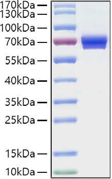 Recombinant Human IL-2RA/CD25 Protein was determined by SDS-PAGE under reducing conditions with Coomassie Blue.