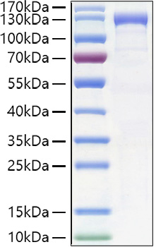 Recombinant Human CDH6/K-Cadherin Protein was determined by SDS-PAGE under reducing conditions with Coomassie Blue.