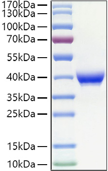 Recombinant Human Fc epsilon RII/CD23 Protein was determined by SDS-PAGE under reducing conditions with Coomassie Blue.