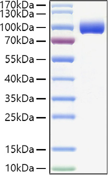 Recombinant Human PIgR Protein was determined by SDS-PAGE under reducing conditions with Coomassie Blue.