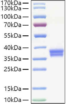 Recombinant Human VSIG3/IgSF11 Protein was determined by SDS-PAGE under reducing conditions with Coomassie Blue.