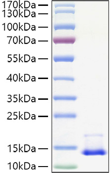 Recombinant Human CCL2/MCP-1 Protein was determined by SDS-PAGE under reducing conditions with Coomassie Blue.