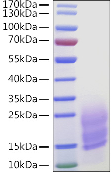 Recombinant Human Fibronectin/CIG/FN1 Protein was determined by SDS-PAGE under reducing conditions with Coomassie Blue.