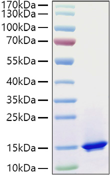 Recombinant Mouse Complement C3 Protein was determined by SDS-PAGE under reducing conditions with Coomassie Blue.
