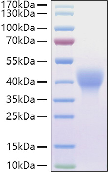 Recombinant Mouse Leukemia inhibitory factor/LIF Protein was determined by SDS-PAGE under reducing conditions with Coomassie Blue.