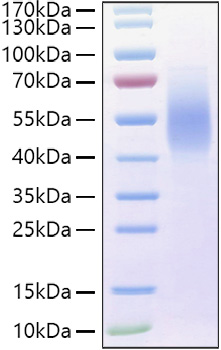 Recombinant Human MUC-16/CA125 Protein was determined by SDS-PAGE under reducing conditions with Coomassie Blue.