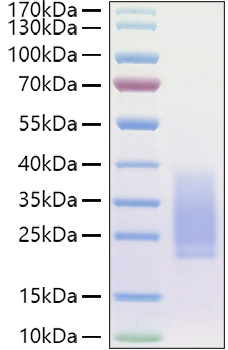 Recombinant Human BMPR-2 Protein was determined by SDS-PAGE under reducing conditions with Coomassie Blue.