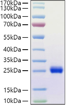 Recombinant Human Ephrin-A1/EFNA1 Protein was determined by SDS-PAGE under reducing conditions with Coomassie Blue.
