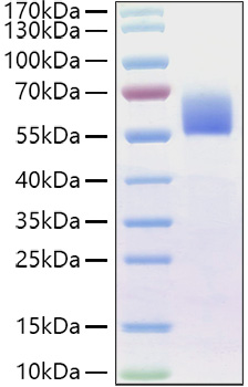 Recombinant Human BMPR-2 Protein was determined by SDS-PAGE under reducing conditions with Coomassie Blue.