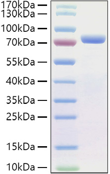 Recombinant Human E-Cadherin/CDH1/CD324 Protein was determined by SDS-PAGE under reducing conditions with Coomassie Blue.