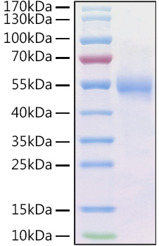 Recombinant Human Frizzled-2/FZD2 Protein was determined by SDS-PAGE under reducing conditions with Coomassie Blue.