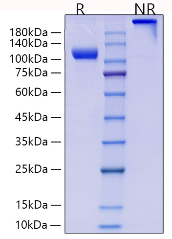 Recombinant Human Endoglin/ENG/CD105 Protein was determined by SDS-PAGE under reducing (R) and non-reducing (NR) conditions.