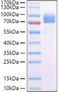 Recombinant Cynomolgus IL-2RG/CD132 Protein was determined by SDS-PAGE under reducing conditions with Coomassie Blue.
