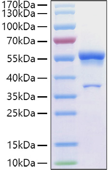 Recombinant Human Ephrin-A1/EFNA1 Protein was determined by SDS-PAGE under reducing conditions with Coomassie Blue.