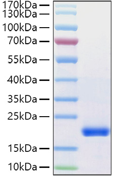 Recombinant Human VEGF-D/FIGF Protein was determined by SDS-PAGE under reducing conditions with Coomassie Blue.