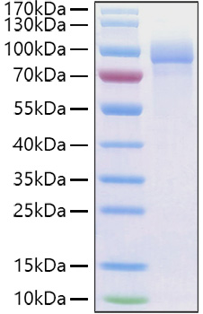 Recombinant Human Fibronectin/CIG/FN1 Protein was determined by SDS-PAGE under reducing conditions with Coomassie Blue.