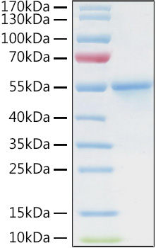 Recombinant Human Carbonic anhydrase 9 Protein was determined by SDS-PAGE under reducing conditions with Coomassie Blue.