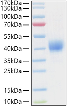 Recombinant Human CD52 Protein was determined by SDS-PAGE under reducing conditions with Coomassie Blue.