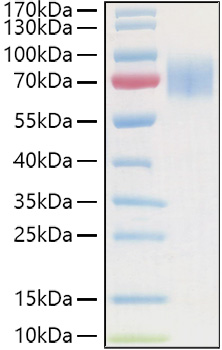 Recombinant Human Guanylyl cyclase C/GUCY2C Protein was determined by SDS-PAGE under reducing conditions with Coomassie Blue.