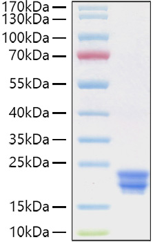 Recombinant Human IFN-alpha 2 Protein was determined by SDS-PAGE under reducing conditions with Coomassie Blue.