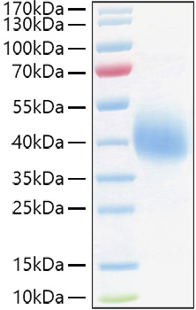Recombinant Human TFPI Protein was determined by SDS-PAGE under reducing conditions with Coomassie Blue.