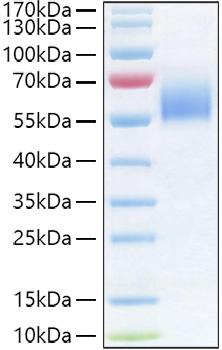 Recombinant Human IL-36R/IL-1Rrp2/IL1RL2 Protein was determined by SDS-PAGE under reducing conditions with Coomassie Blue.