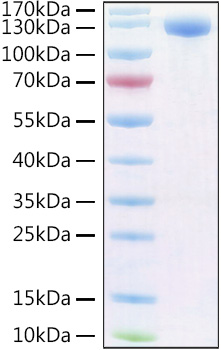 Recombinant Human PIgR Protein was determined by SDS-PAGE under reducing conditions with Coomassie Blue.