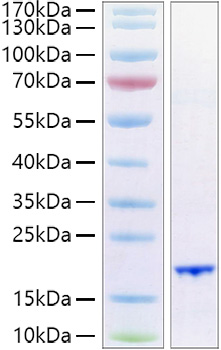 Recombinant Human FGF-6 Protein was determined by SDS-PAGE under reducing conditions with Coomassie Blue.