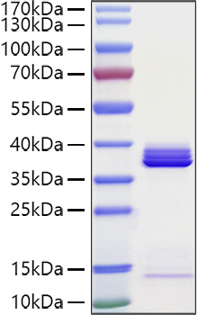 Recombinant Human Apolipoprotein E/ApoE Protein was determined by SDS-PAGE under reducing conditions with Coomassie Blue.