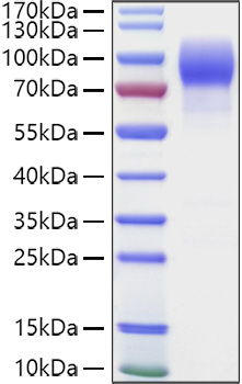 Recombinant Human MUC-16/CA125 Protein was determined by SDS-PAGE under reducing conditions with Coomassie Blue.
