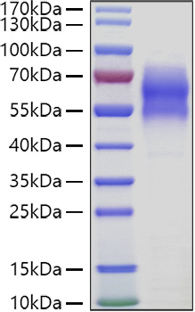 Recombinant Human WAIF1/5T4/TPBG Protein was determined by SDS-PAGE under reducing conditions with Coomassie Blue.