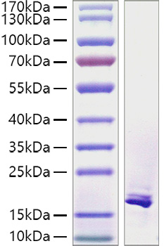 Recombinant Human TNFSF12/TWEAK Protein was determined by SDS-PAGE under reducing conditions with Coomassie Blue.
